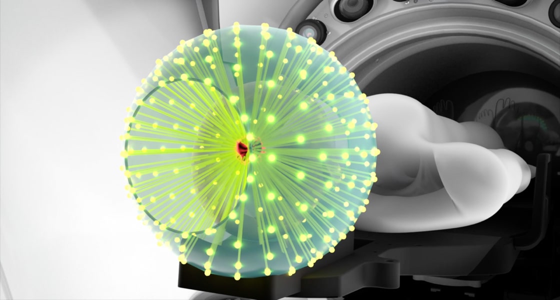 ZAPX Gyroscopic Stereotactic Radiosurgery for the Brain